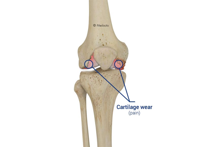 knee anatomy