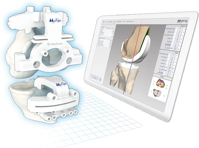 MyKnee®