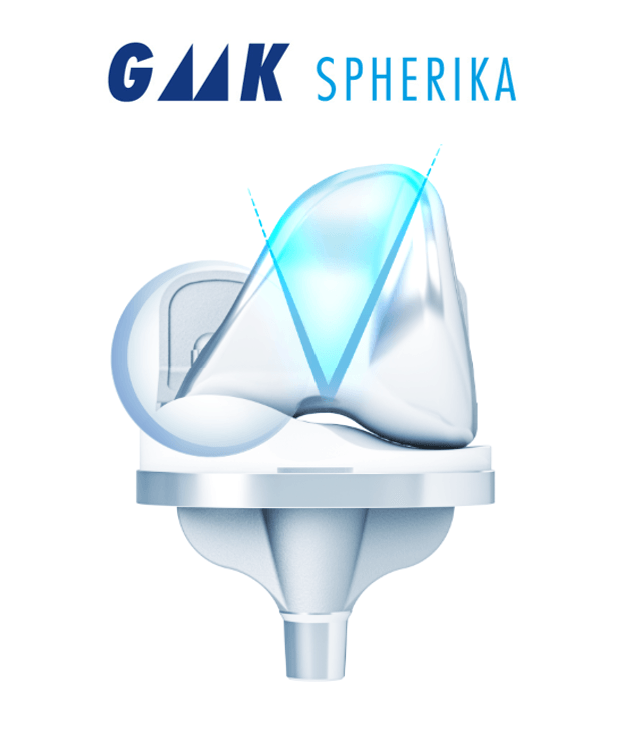 The Medacta GMK SpheriKA knee implant