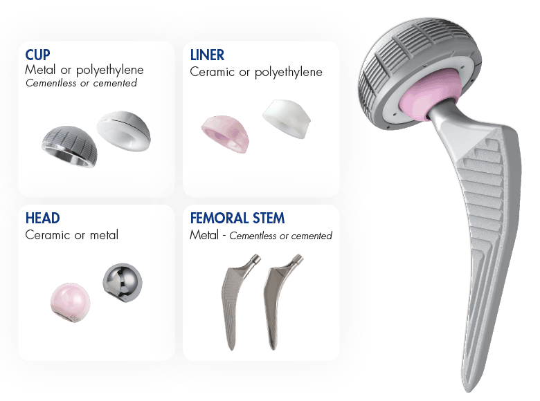 hip replacement