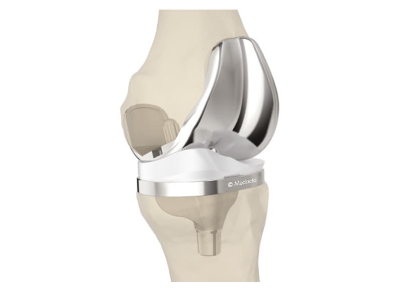 MyKnee®